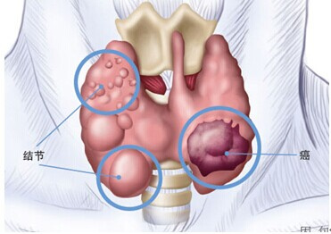 发现体检结果异常该怎么办,体检发现异常指标是怎么回事