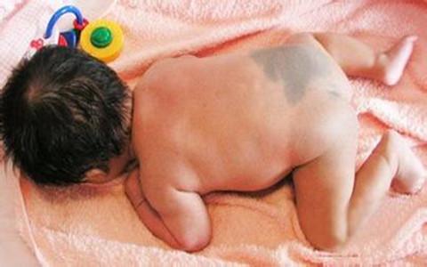 新生儿的各种胎记怎么避免,宝宝哪几种胎记很危险