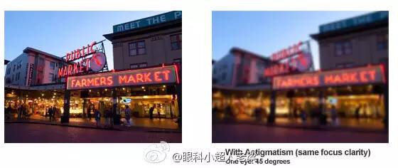 儿童近视眼家长也不用太焦虑,孩子散光几岁治疗最好