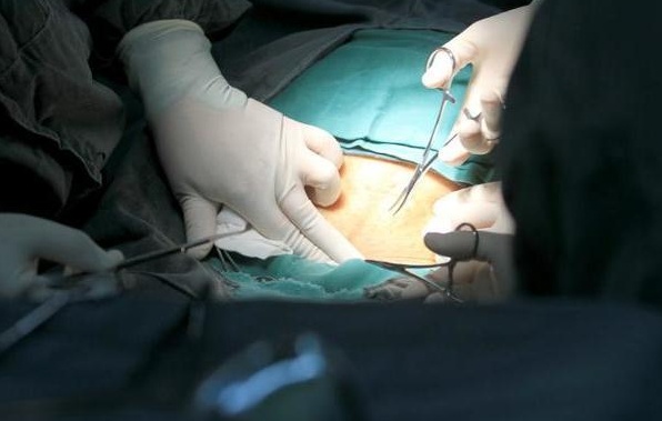 剖腹产的全流程真实记录,顺产剖腹产的十个真相