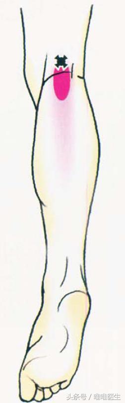 膝盖疼痛治疗经验分享,膝关节总结