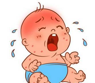 大宝和二宝都是湿疹宝宝，我的处理方法你可以参考一下