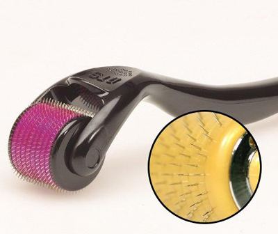 如何修复毛孔粗大和痘坑,痘坑痘印毛孔粗大的区别