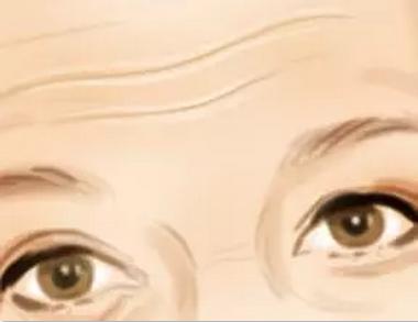 击退抬头纹最有效的方法,拥有年轻无瑕肌肤告别女生抬头纹