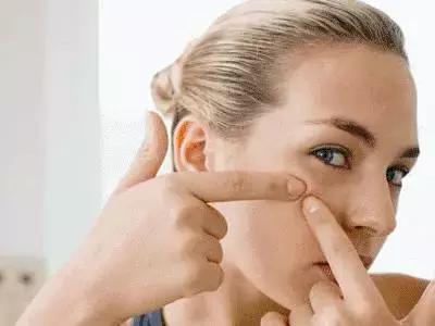 去黑头小妙招你的黑头有救了,别挤了教你去黑头的正确方法