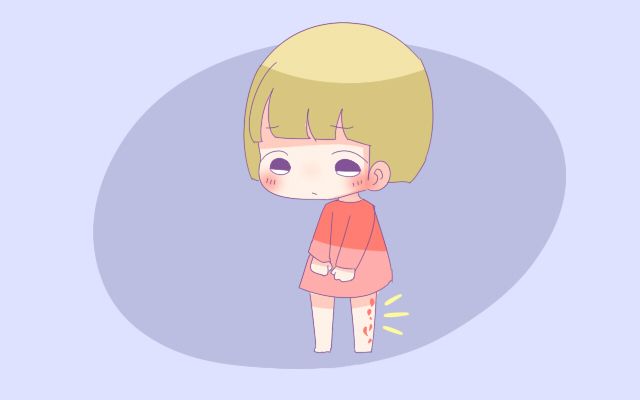 宝宝身上胎记如何去除,你们家宝宝身上都有胎记吗