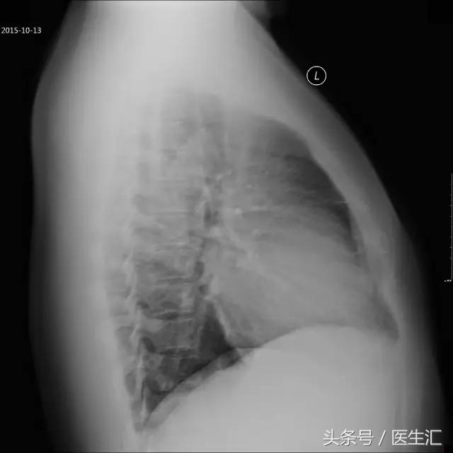 25岁能得心脏病吗,20岁就得了心衰