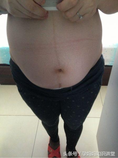 胎儿生男生女,b超怎么看出胎儿姓名