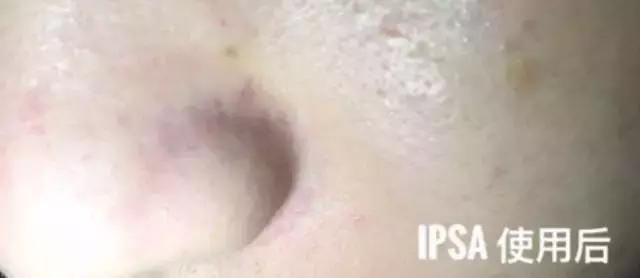 巧克力面膜美白淡斑去黑头粉刺,去黑头粉刺涂抹式面膜好物分享