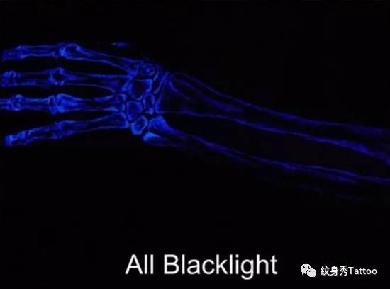 它是夜店的焦点，时尚的宠儿，医院……的心病……