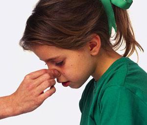 孩子鼻子痒一揉就流鼻血,8岁孩子流鼻血怎么回事