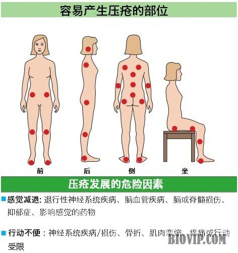 长期卧床怎么会有皮疹,长期卧床患者出现皮肤溃烂