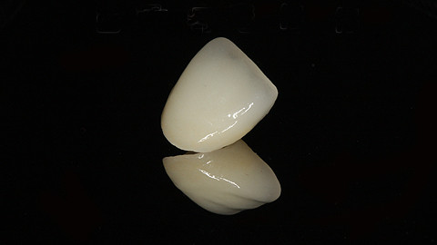 义齿怎么辨别真假,学会三招让你远离伪劣义齿