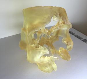 世界之最甩你几条街？NewPro3D45分钟打印完整头骨