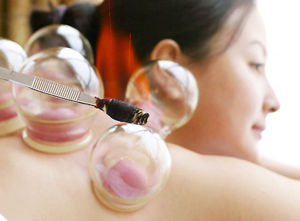 中医拔罐疗法的临床应用,中医拔罐疗法为什么是安全的