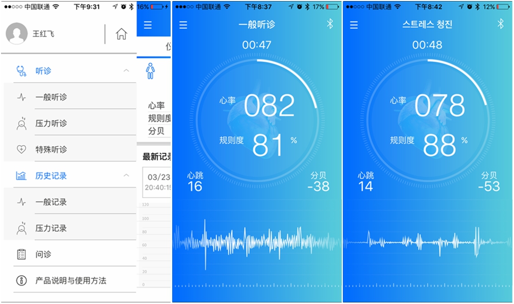 智能心脏检测器,实时心脏监测手环