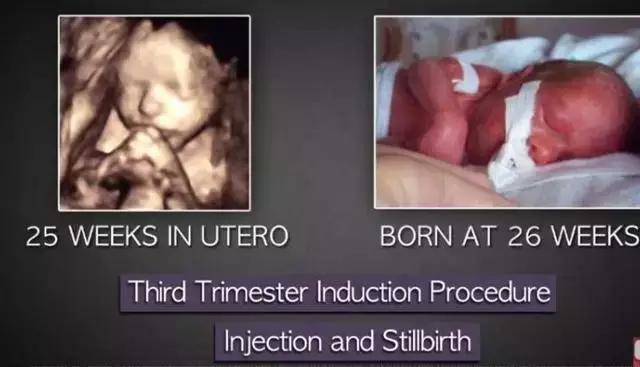 LAN《性、安全、录像带》