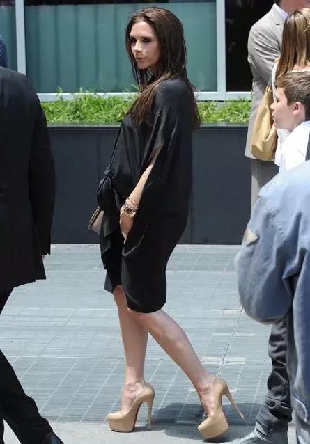 贝克汉姆的脚变形,贝克汉姆老婆脚外翻