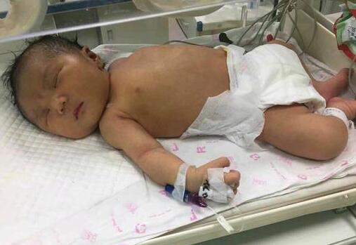 奶奶为了面子竟对半岁宝宝这样做，听了医生的话后十分后悔！