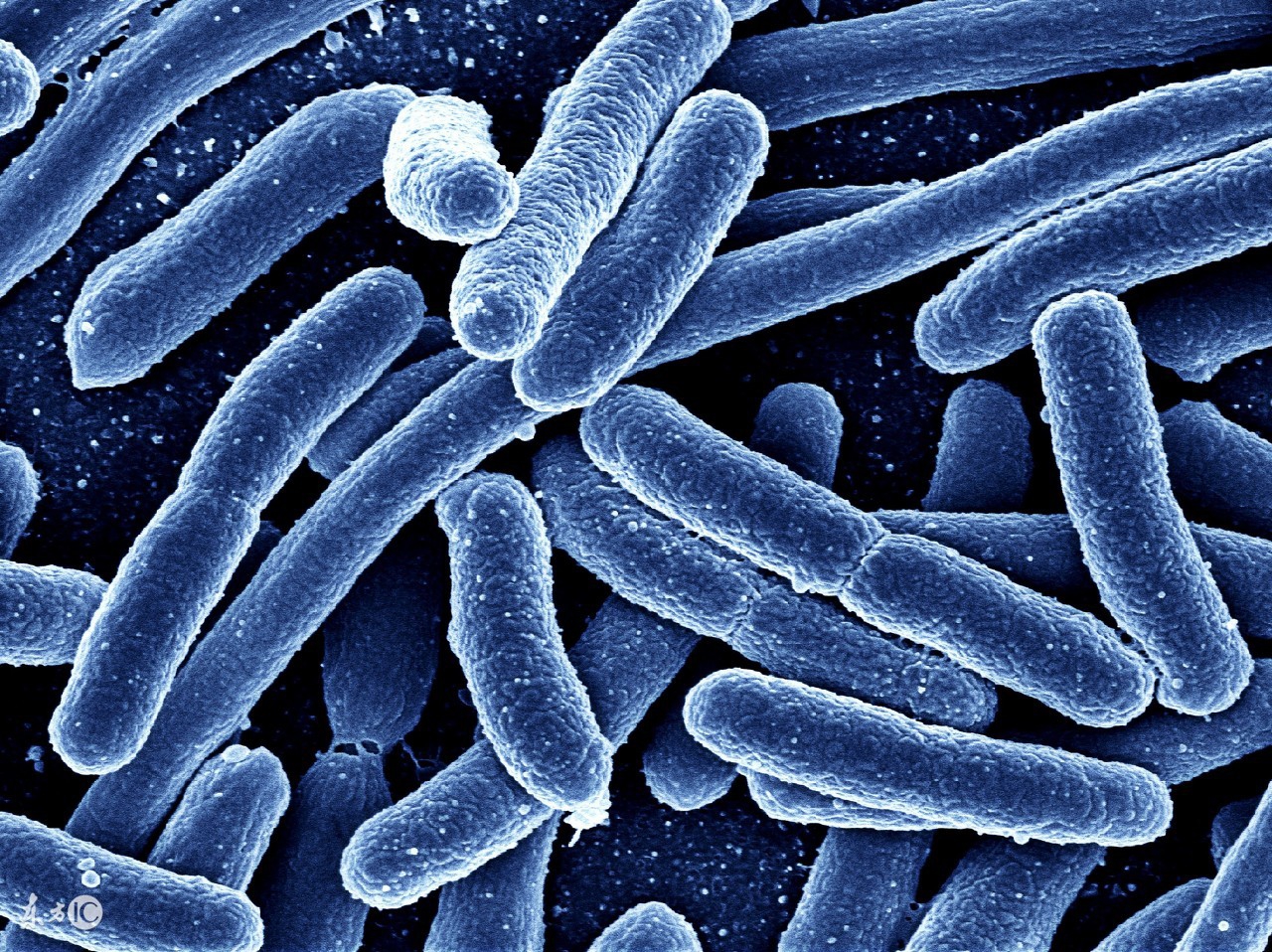 肠道变黑了怎么补救,肠道变黑吃什么药最好