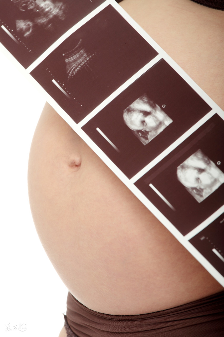 教你如何轻松看懂b超单,怎么看懂b超图和实际图