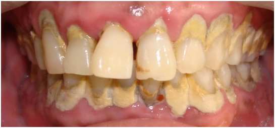 你和女神的距离就差一步,你与女神的距离只差一个下巴