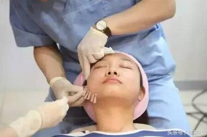 无创提升苹果肌,无创和微创技术