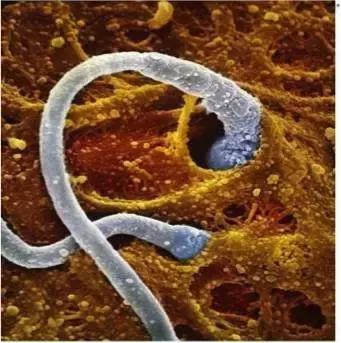 输卵管积水能移植吗,输卵管为什么会有积水