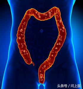 自身免疫性疾病的最新疗法,自身免疫性疾病吃什么药