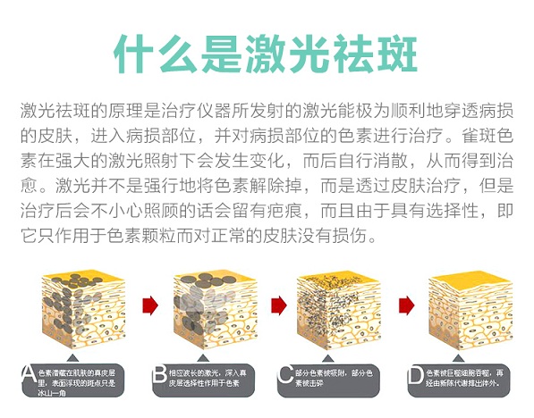 什么是激光祛斑怎么治疗,什么是激光祛斑后的反黑