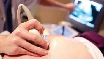 孕妈妈有没有做过绒毛穿刺检查？