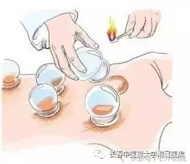 小儿疱疹性咽峡炎用什么中药贴敷,儿科孙丽萍