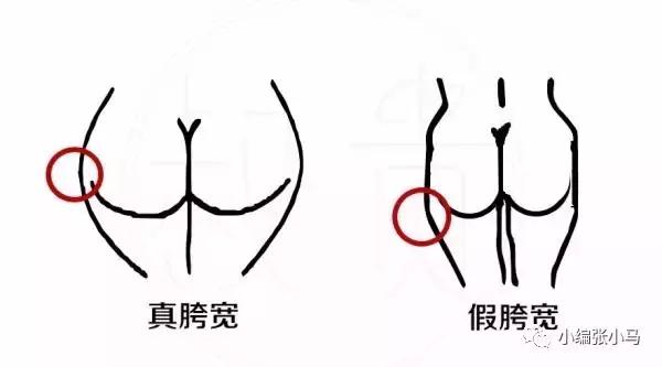假胯宽严重怎么练最快消除,假胯宽大粗腿怎么瘦