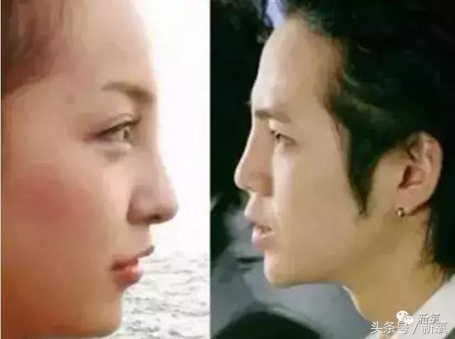 杨紫微整前后容颜对比,杨紫瘦了吗