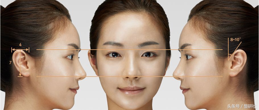 完美耳部成形术功能外观与福气集一身