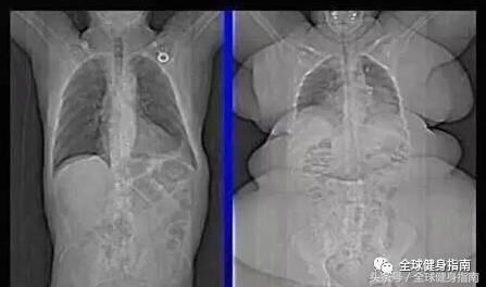 我不是胖我只是骨架大原版,我不是胖我是骨架大