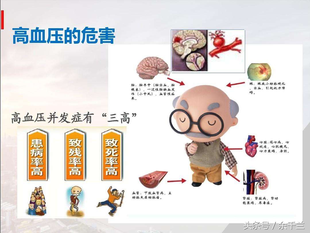 高血压改善血脂有用么,康琼氨基酸能软化血管降血压吗