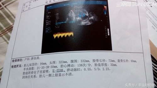 为了孩子的健康妈妈一定要知道,孕期检查妈妈为省钱