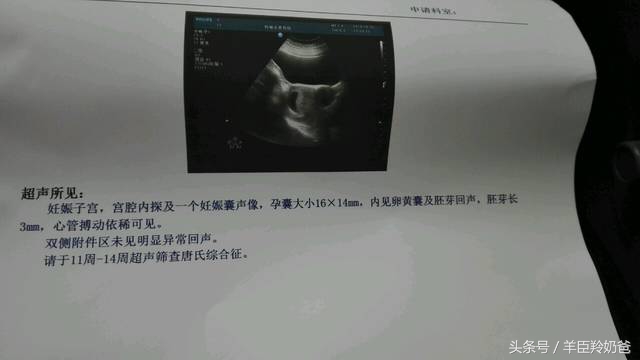 为了孩子的健康妈妈一定要知道,孕期检查妈妈为省钱