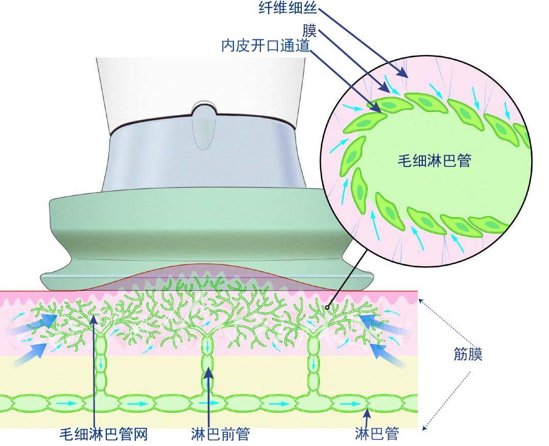 淋巴水肿皮肤发硬怎么治疗,淋巴水肿患者的早期症状
