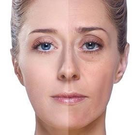 吃胶原蛋白片有用吗,胶原蛋白会跟着皮肤长吗