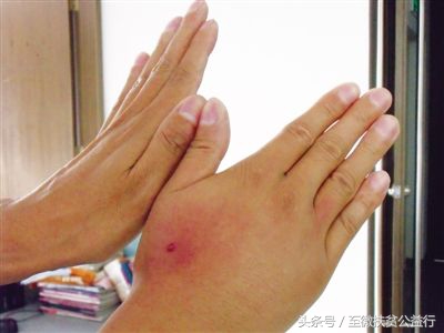 农村动物界的“四大天王”!招惹它们定会让你痛不欲生!