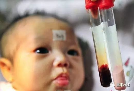 儿童发烧血常规解读,儿童感冒发烧的基本常识