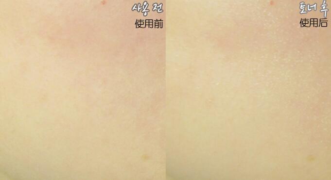 韩国做一次头发多少钱,韩国黄金面膜的用法和用量是多少