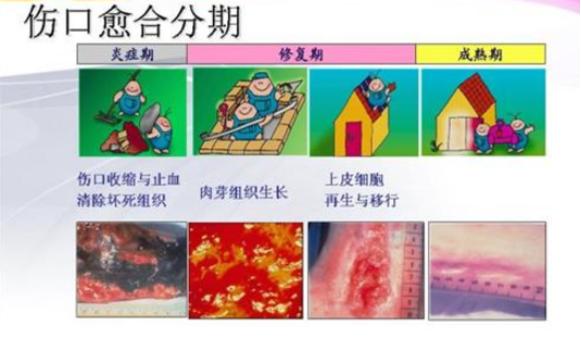 手术后要忌口的发物有哪些,卵巢囊肿术后忌口发物