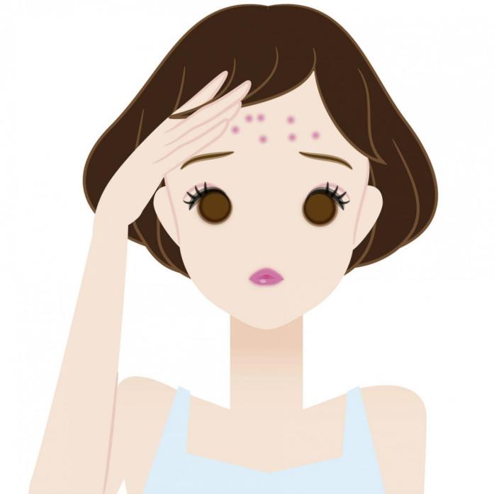 额头两颊长痘痘是什么原因,额头两颊长痘是什么原因