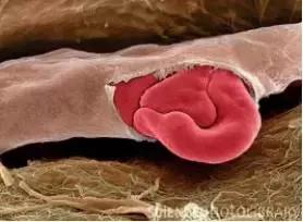 啊！没错，我今天要拯救你们的脸于水火之中！