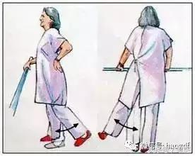 髋关节置换术后康复护理app,髋关节置换后护理康复训练视频