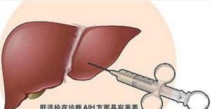 中医对乙肝是怎么治疗的,中医治愈乙肝的标准