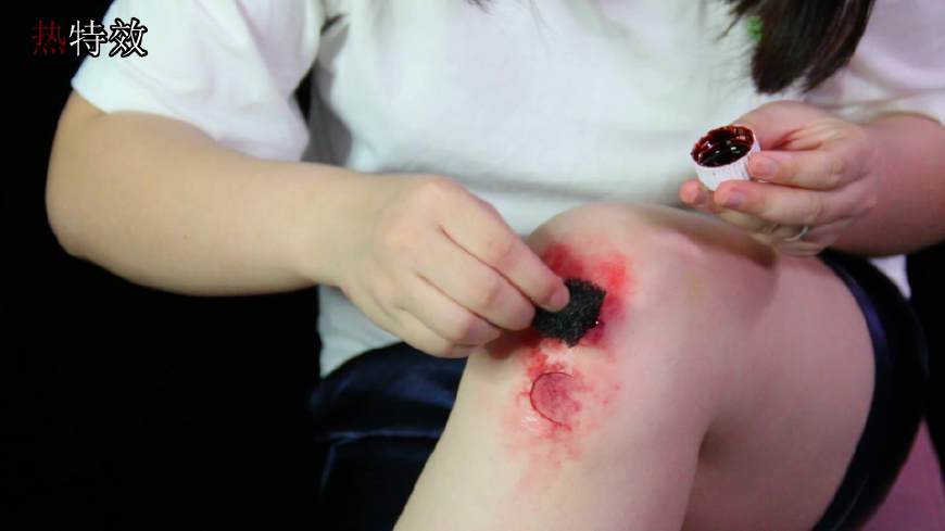 膝关节损伤揭秘,膝盖损伤科普动画视频